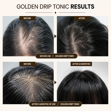 Golden Drip 64K Korean Scalp Cooling Hair Tonic | Deep Cleansing & Scalp Balance Care - 110ml
