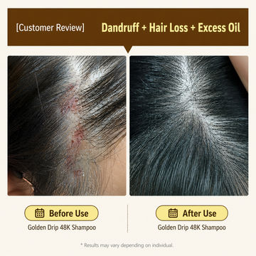 (W)Golden Drip 48K Korean Scalp Shampoo | Deep Cleansing & Scalp Balance Care - 255ml