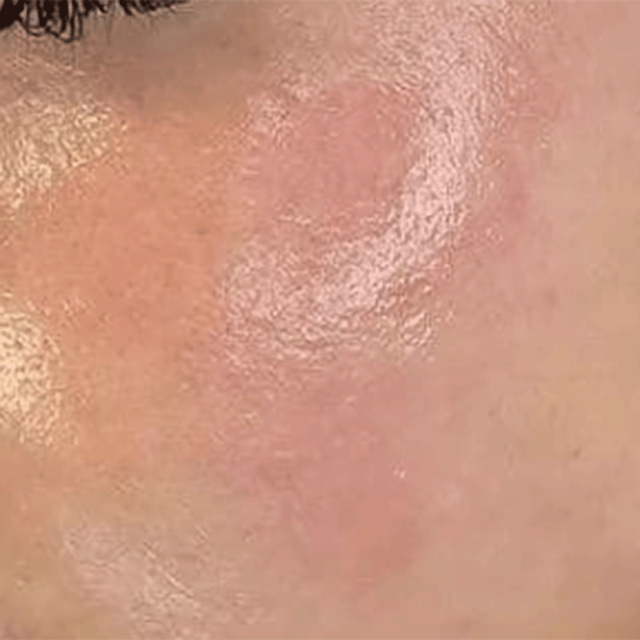 Firmness & Elasticity after