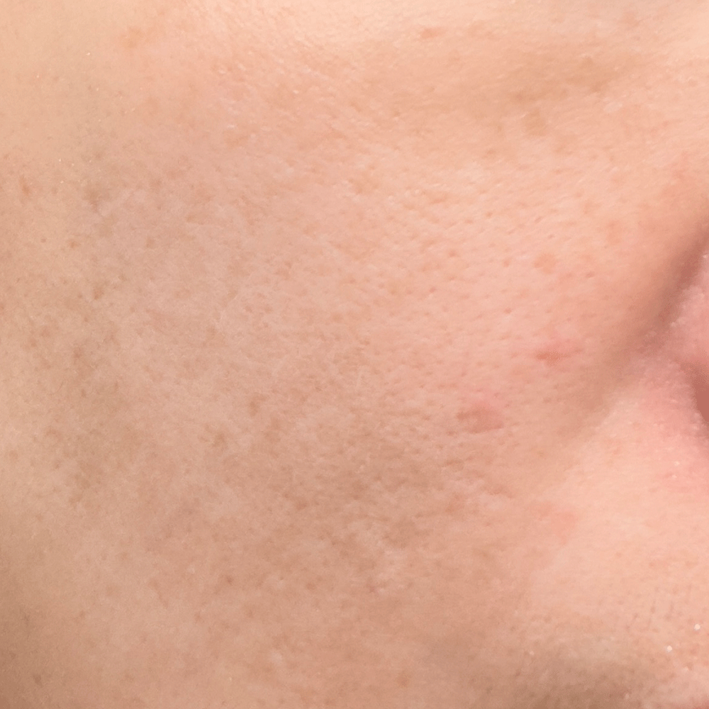 01. Clean Skin Before Skincare