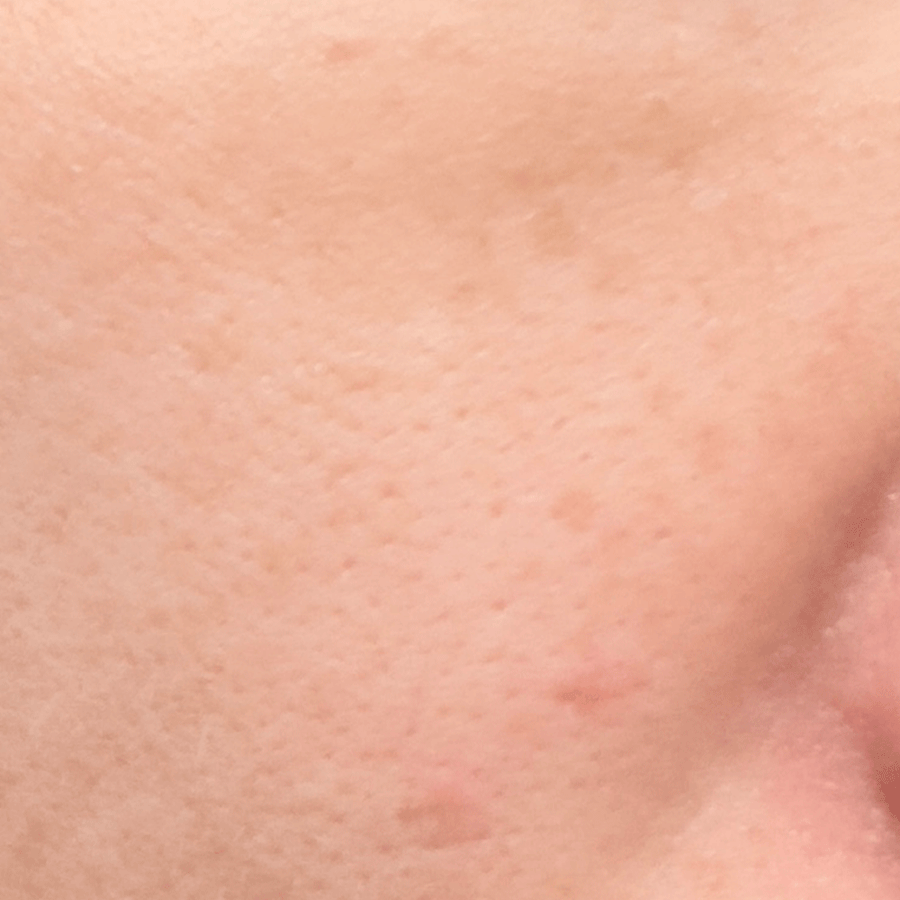 Tone, Texture & Pore Care before