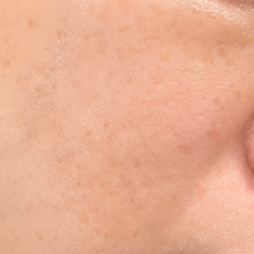 04. Skin After Daily Skincare