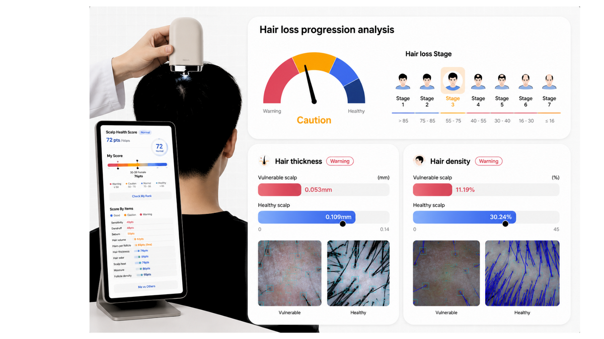 Becon AI scalp image