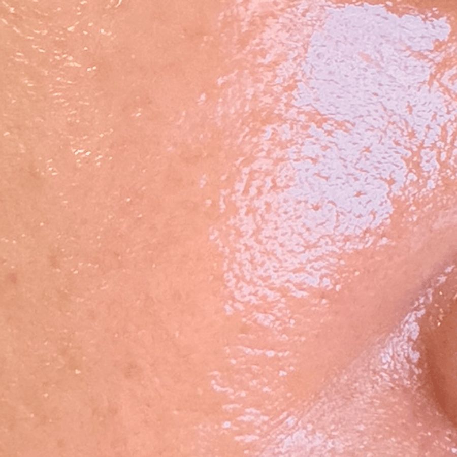 Tone, Texture & Pore Care after