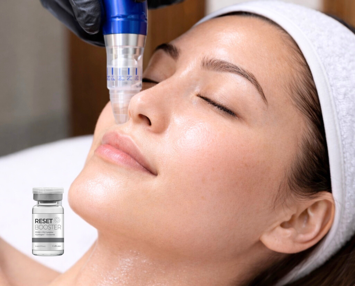 Microneedling Treatment